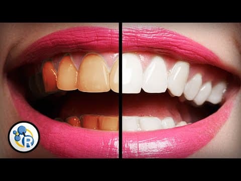 What's The Best Way To Whiten Teeth?