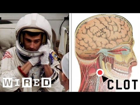 NASA Flight Surgeon Explains How to Treat a Blood Clot in Space | WIRED