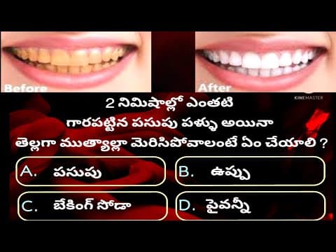 gk questions,answers|telugu gk|human life gk questions|gk bits|gk questions and answers telugu|Ep35