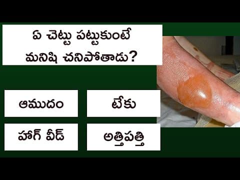 Interesting Telugu Quiz Question and Answers | Telugu General Knowledge Quiz Episode - 5