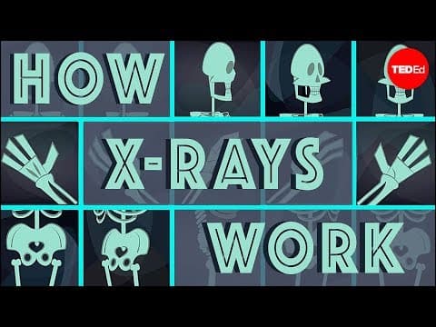 How X-rays see through your skin - Ge Wang - YouTube