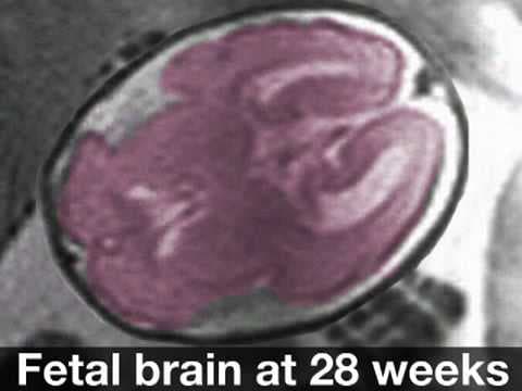 Fetal Development Week 28 (Pregnancy Health Guru)