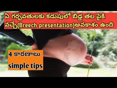 ఏ గర్భవతులకు బిడ్డ తల పైకి వచ్చే ఛాన్స్ ఉంది/Breech position in Telugu