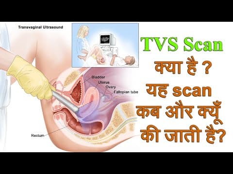 Tvs sonography in hindi i tvs sonography क्या है और यह कैसे की जाती ह-ultrasound in pregnancy i