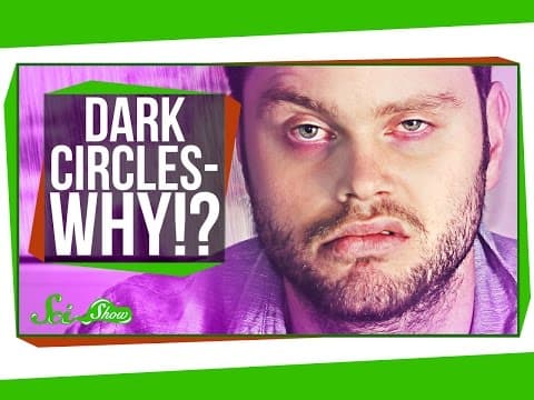 Why Do I Get Dark Circles Under My Eyes?