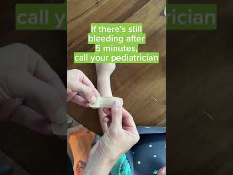 What you should do if your child starts bleeding?