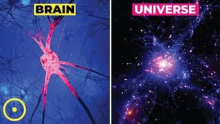 Why Does the Brain Resemble the Universe
