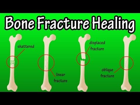How Does A Bone Break Heal - Bone Fracture Healing Process