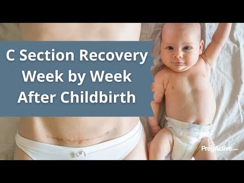 C section recovery week by week