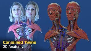 Two Heads One Body  Anatomy of Conjoined Twins