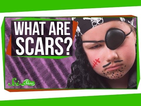 What are Scars?