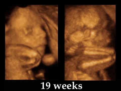 Fetal Development Week 19 (Pregnancy Health Guru)