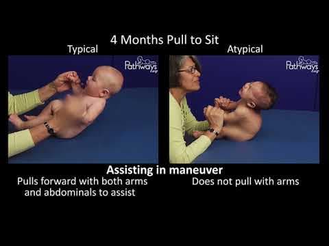 4 month old baby typical & atypical development side by side