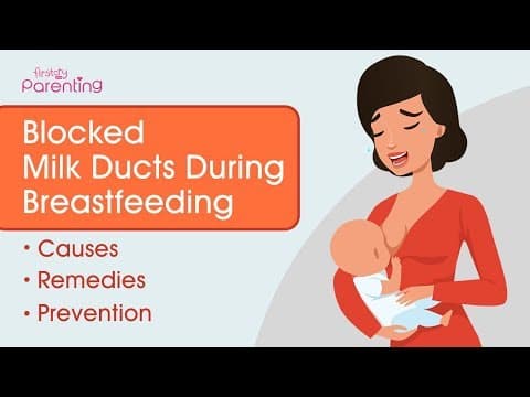 Blocked Milk Ducts During Breastfeeding - Causes, Remedies and Prevention