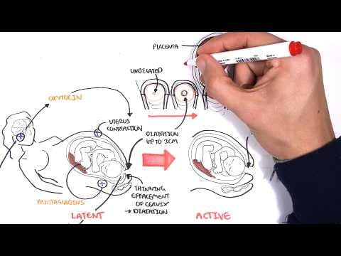 Obstetrics - Stages of Labour