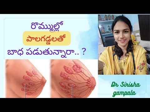 పిల్లలకి పాలు ఆపేటప్పుడు రొమ్ము గడ్డలు రాకుండా ఉండాలంటే..|| Breast engorgement || Health tips