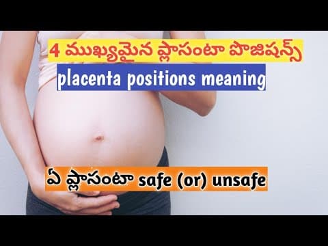 placenta positions meaning /4 ముఖ్యమైన placenta positions during pregnancy