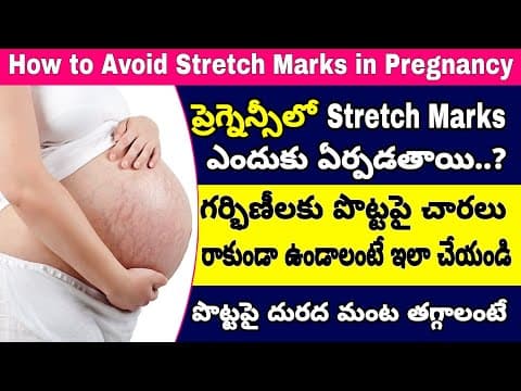 ప్రెగ్నెన్సీలో పొట్టపై చారలు రాకుండా ఉండాలంటే? | How to Avoid Stretch Marks During Pregnancy
