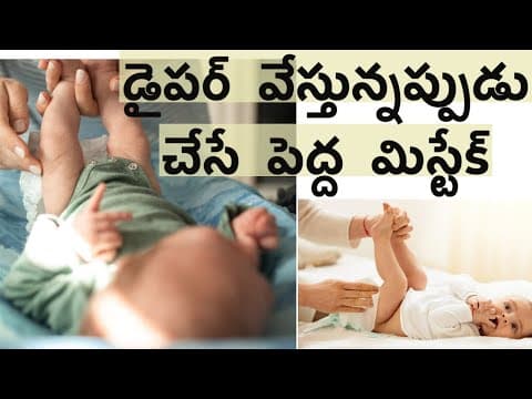 డైపర్ వేస్తున్నప్పుడు చేసే పెద్ద మిస్టేక్ - how to put diaper to baby?