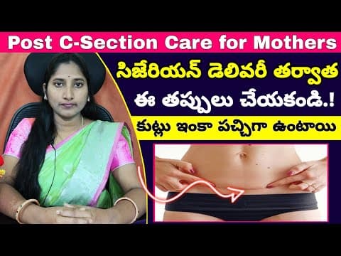 సీజరియన్ డెలివరీ తర్వాత ఇవి చేయకండి | Don't Mistakes After Cesarean Delivery | C-Section Delivery