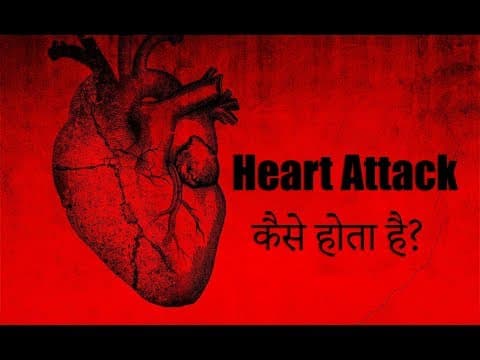 Heart Attack कैसे होता है?