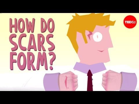 How do scars form? - Sarthak Sinha - YouTube